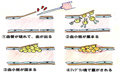 止血について