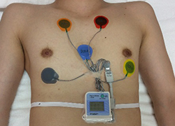 Holter ECG setting conditions