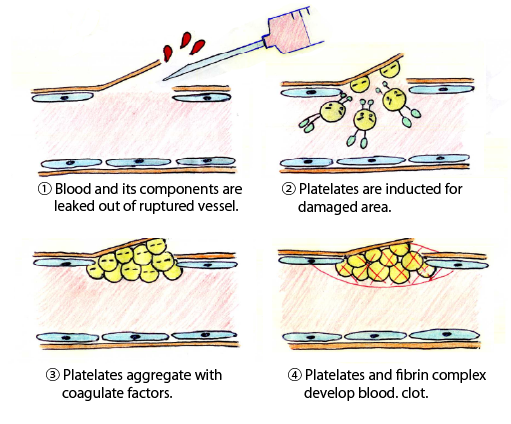 Regarding hemostasis
