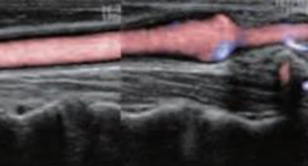 Healthy vascular image