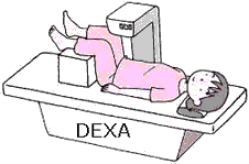 Bone densitometry examination images