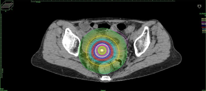 RALS Horizontal cross-section images